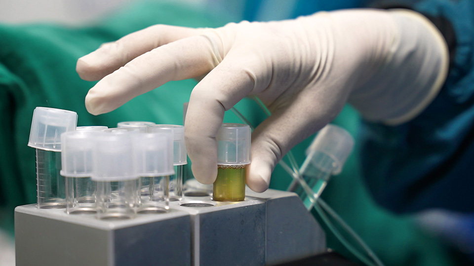 IVF Procedure at Birat IVF